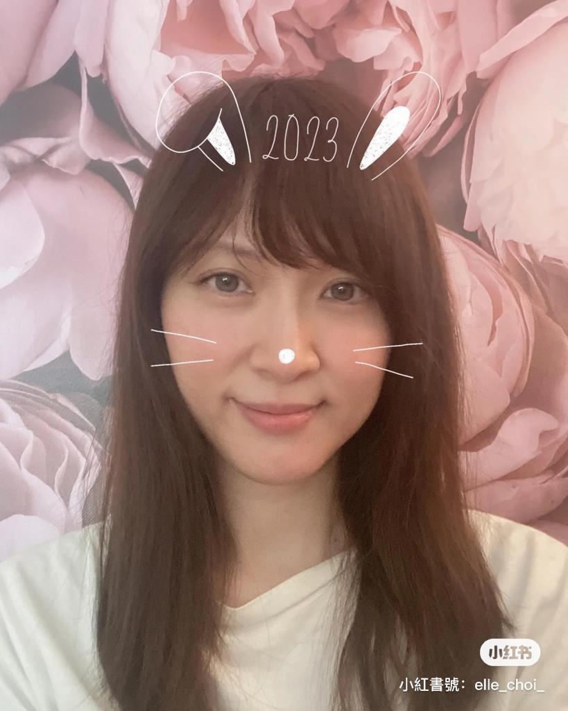 有網民指她兩頰下垂。